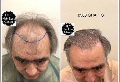 8021 493388e7535c